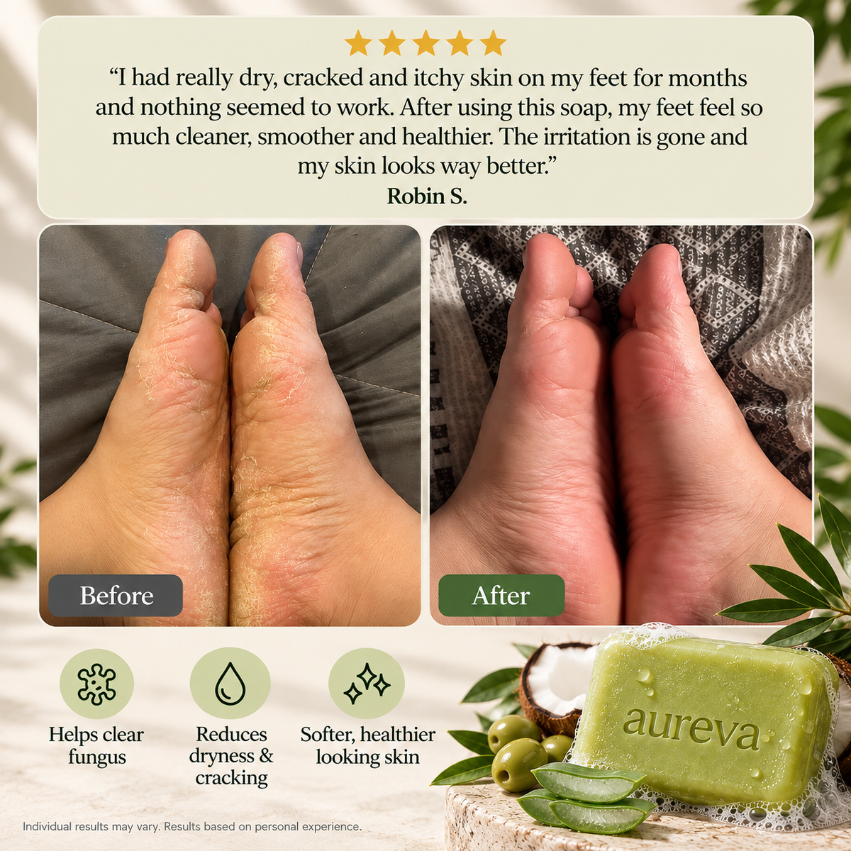 Antifungal Tea tree Soap